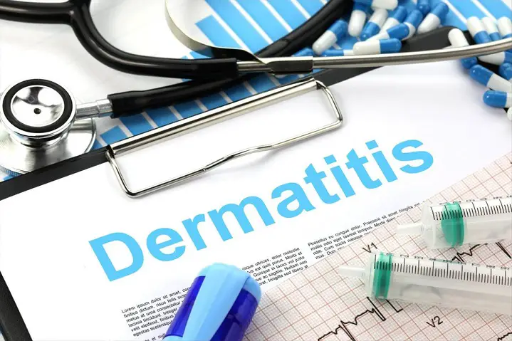 This Article related to dermatitis causes, types and managment